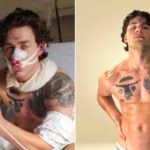 New York Model John Rudat Fights Off Attackers
