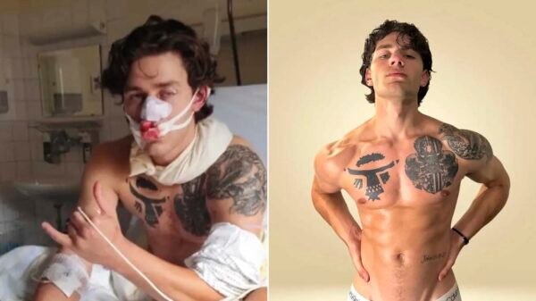 New York Model John Rudat Fights Off Attackers